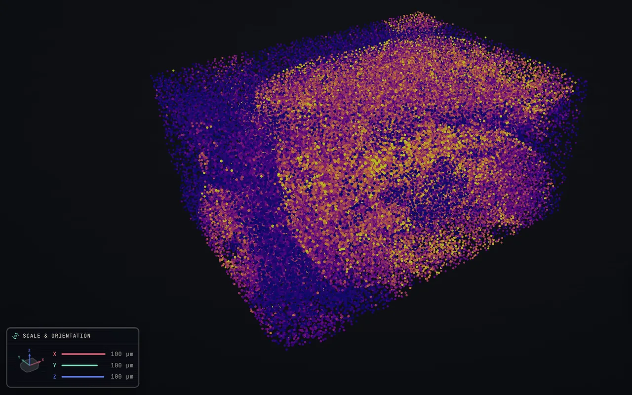 A HER2⁺ breast carcinoma imaged by 3D imaging mass cytometry, drawn as a volume of cells coloured by HER2, with the Scale and orientation panel and its X, Y and Z bars.