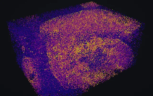 A HER2⁺ breast carcinoma imaged by 3D imaging mass cytometry, drawn as a volume of cells coloured by HER2, with the Scale and orientation panel and its X, Y and Z bars.