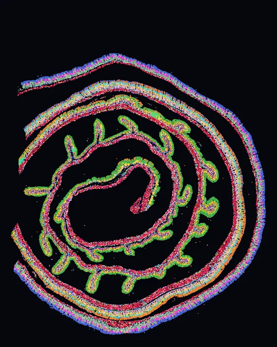 A Xenium 5K mouse colon section, rolled into a spiral: every cell drawn as a point in its cell-type colour.