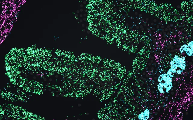 Molecules of Epcam, Acta2 and Lyz1 as green, pink and cyan glowing spots over the greyed cells of a Xenium 5K mouse tissue microarray.